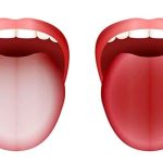 زبان سفید چه چیزی درباره سلامت می‌گوید؟